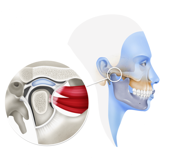 Abordaje multidisciplinario ATM Dentalemán