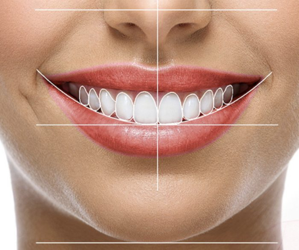 Diseño de Sonrisa