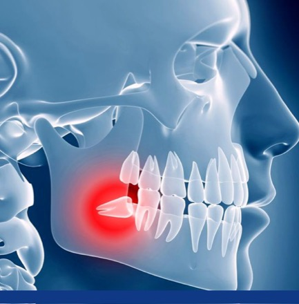 cirugía maxilofacial