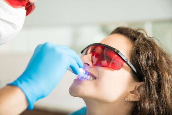 Blanqueamiento dental con láser en Mérida