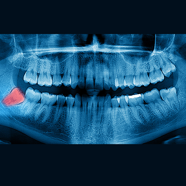 maxilofacial en mérida