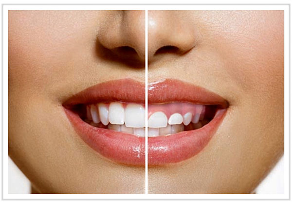 Periodoncia en Dentalemán