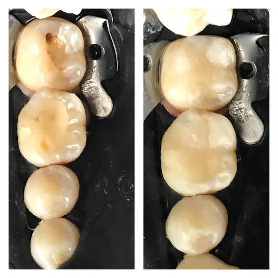Experiencia en Clínica Dentalemán Mérida